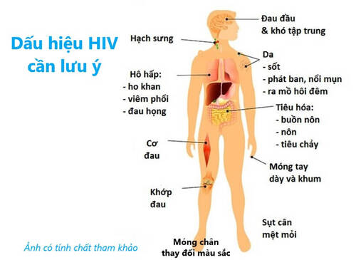 Dấu hiệu HIV cần lưu ý