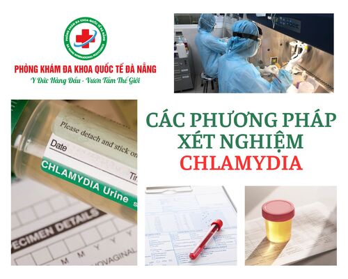 Địa chỉ xét nghiệm, khám chữa Chlamydia tại Đà Nẵng