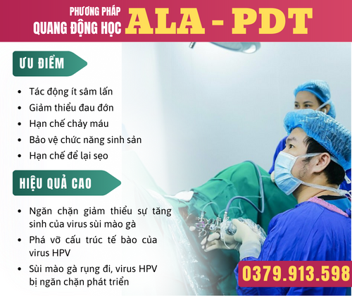 chữa sùi mào gà bằng phương pháp ALa- PDT